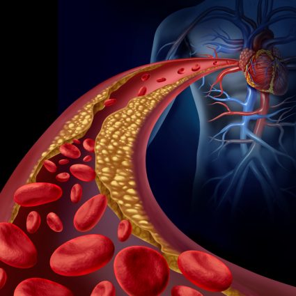 cholesterol and red yeast rice